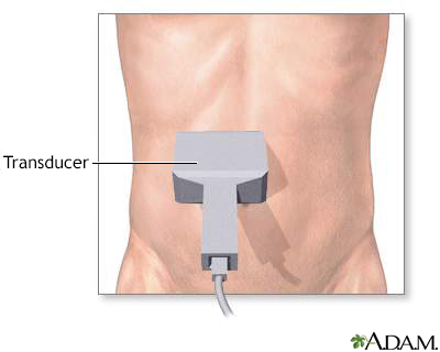 Abdominal ultrasound - Illustration Thumbnail                      
