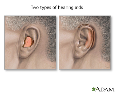 Hearing aids - Illustration Thumbnail                      