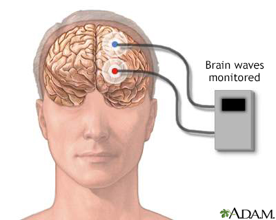 Brain wave monitor - Illustration Thumbnail                      