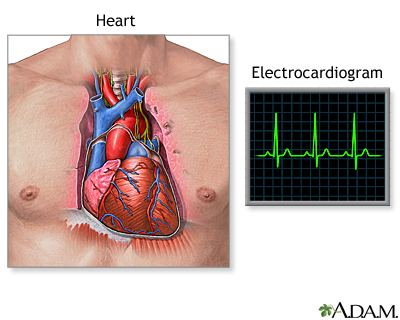 Electrocardiogram (ECG) - Illustration Thumbnail                      