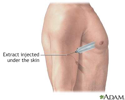 Antigen injection - Illustration Thumbnail                      