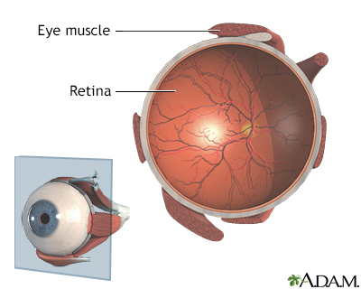 Retina - Illustration Thumbnail                      