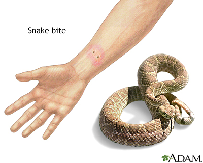Snake bite - Illustration Thumbnail                      