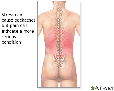 Backaches - Illustration Thumbnail                      
