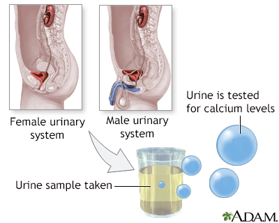 Calcium urine test - Illustration Thumbnail                      