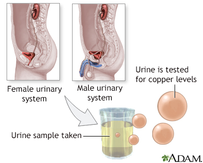 Copper urine test - Illustration Thumbnail                      