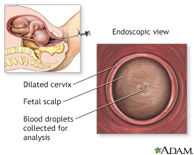 Fetal blood testing - Illustration Thumbnail                      
