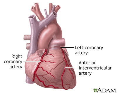 Anterior heart arteries - Illustration Thumbnail                      