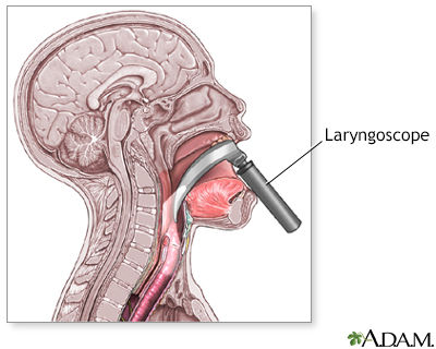 Laryngoscope - Illustration Thumbnail                      