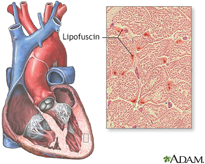 Lipofuscin - Illustration Thumbnail                      