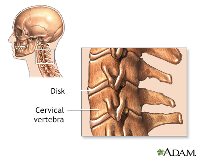Cervical vertebrae - Illustration Thumbnail                      