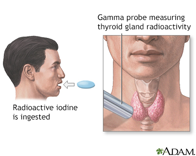 Thyroid uptake test - Illustration Thumbnail                      