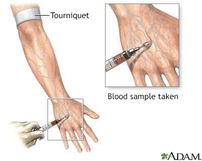 Blood test - Illustration Thumbnail                      