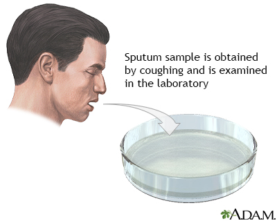 Sputum test - Illustration Thumbnail                      