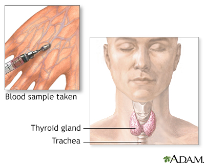 Thyroid function test - Illustration Thumbnail                      