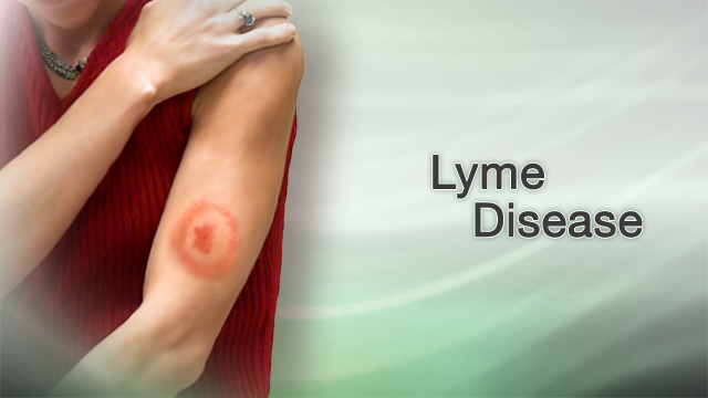 Lyme disease