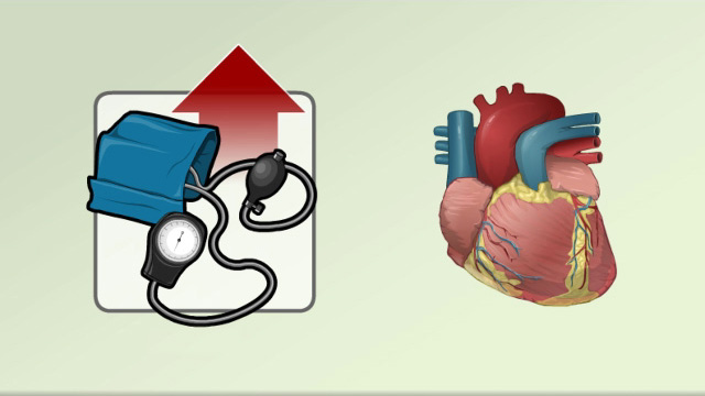 Cardiac hypertension hypertrophy