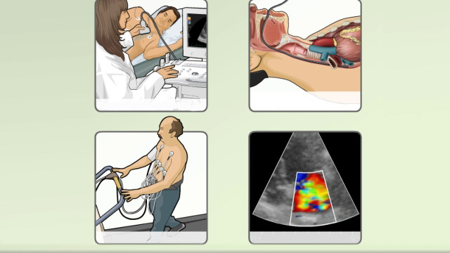 Types of echocardiography